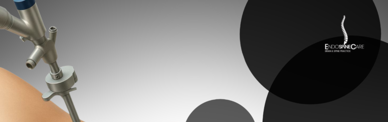 Understanding Endoscopic Discectomy: A Minimally Invasive Solution for Herniated Discs