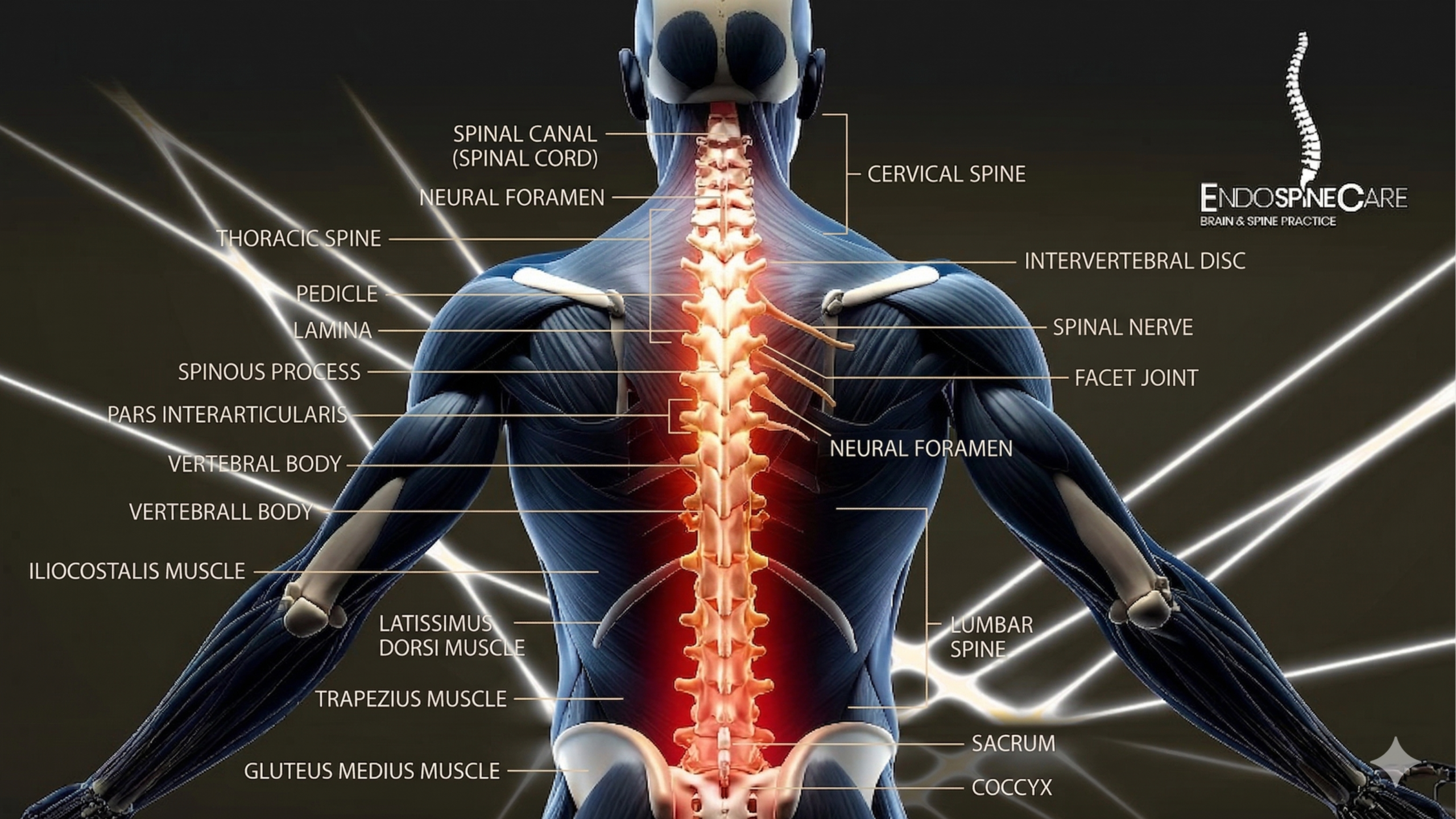 Who Is a Good Candidate for Endospine Procedures?